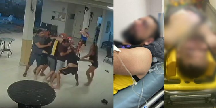 Câmera de condomínio em Manaus registra pancadaria entre moradores; homem ficou desfigurado
