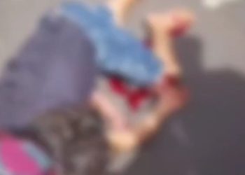 Vídeo forte: Jovem sofre fratura exposta após cair de moto em Manaus