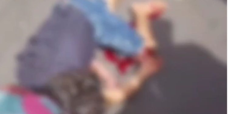 Vídeo forte: Jovem sofre fratura exposta após cair de moto em Manaus