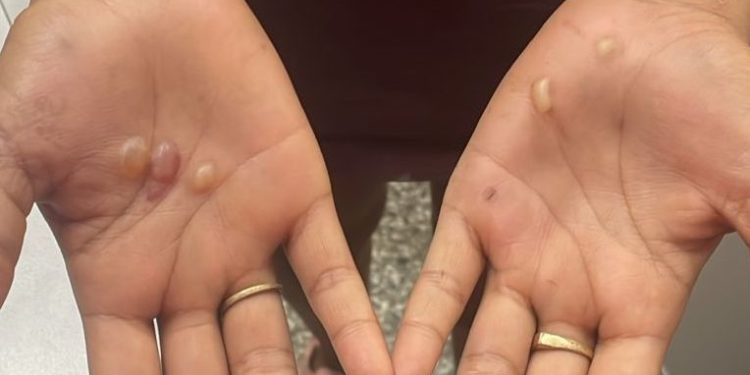 Menina de 12 anos é torturada por duas mulheres em Manaus; uma suspeita foi presa