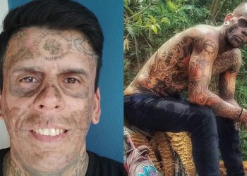 'Mais tatuado do Brasil' passa por 3ª sessão de remoção de tatuagens após se tornar evangélico