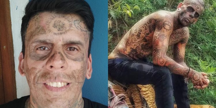 'Mais tatuado do Brasil' passa por 3ª sessão de remoção de tatuagens após se tornar evangélico