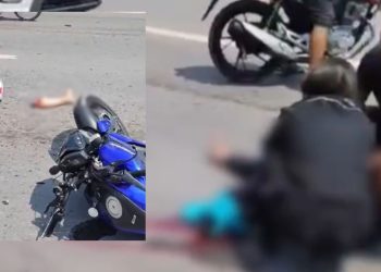 Vídeo forte: passageira tem perna arrancada em acidente de moto na Avenida das Torres