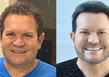 Ximbinha surge com rosto ‘novo’ e deixa internautas em choque: ‘quem é esse?’