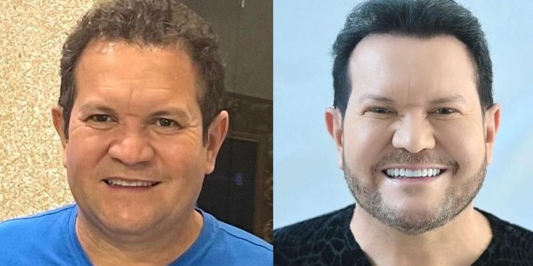 Ximbinha surge com rosto ‘novo’ e deixa internautas em choque: ‘quem é esse?’