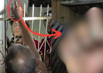 Vídeo mostra grade de ferro que 'varou' mão de idoso em Parintins