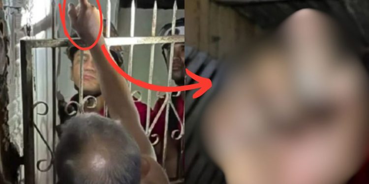 Vídeo mostra grade de ferro que 'varou' mão de idoso em Parintins