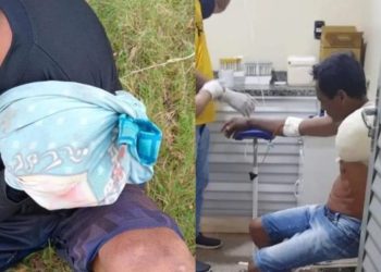 Ataque de jacaré deixa pescador com o braço amputado no interior do Amazonas