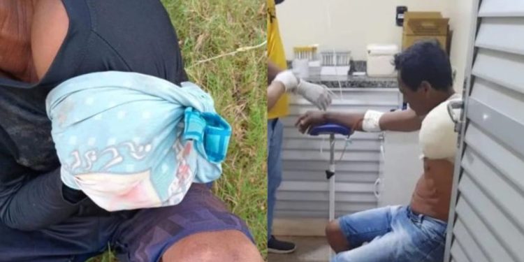 Ataque de jacaré deixa pescador com o braço amputado no interior do Amazonas