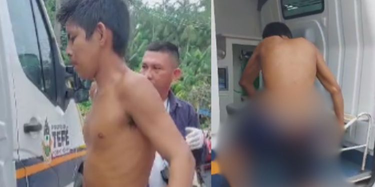 Bandido leva tiro certeiro no 'fiofó' por roubar no interior do Amazonas