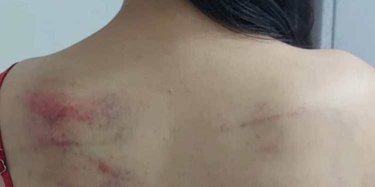 Espancada, criança procura o Conselho Tutelar e denuncia a própria mãe em Manaus