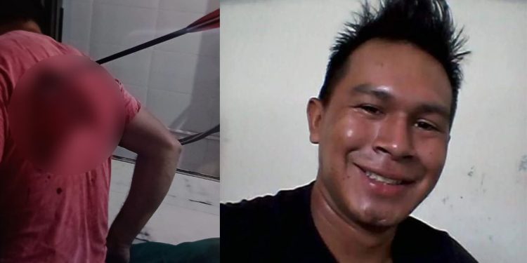 Técnico de enfermagem é morto com flechada pelo colega de trabalho em território Yanomami