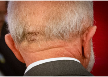 Lula passa por cirurgia de emergência e está na UTI