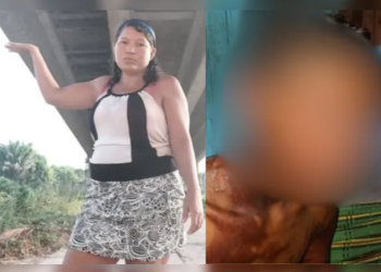 Vídeo forte: Madrasta é presa após queimar enteado com água quente