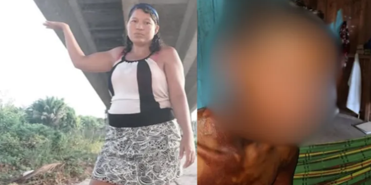 Vídeo forte: Madrasta é presa após queimar enteado com água quente