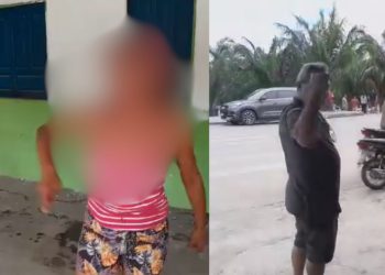 Moradora de rua fica com a boca quebrada após ser agredida por empresário no Amazonas