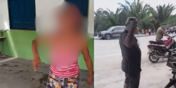 Moradora de rua fica com a boca quebrada após ser agredida por empresário no Amazonas