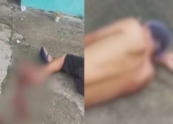 Vídeo forte: Homem pisa em catolé e fica com o pé dilacerado em Manaus