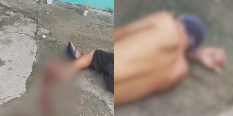 Vídeo forte: Homem pisa em catolé e fica com o pé dilacerado em Manaus