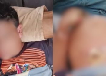 Homem fica no ‘bico do urubu’ ao ser eletrocutado no Amazonas