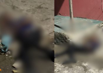 Neguinho' tem os braços quebrados após ser acusado de abus4r de criança em Manaus