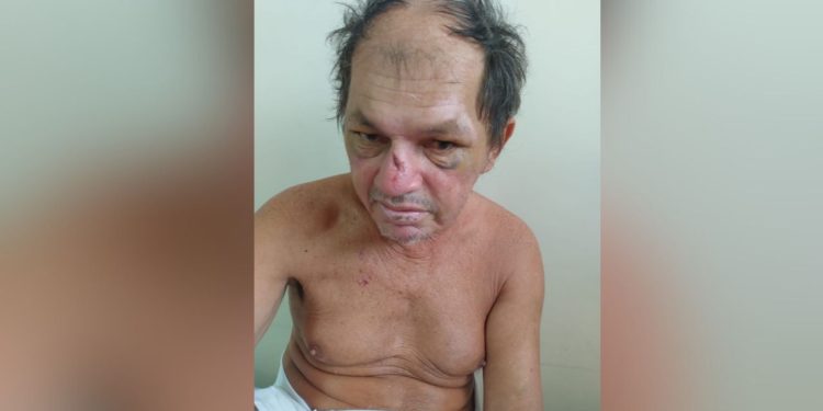 HPS João Lúcio pede ajuda para localizar familiares de paciente vítima de atropelamento