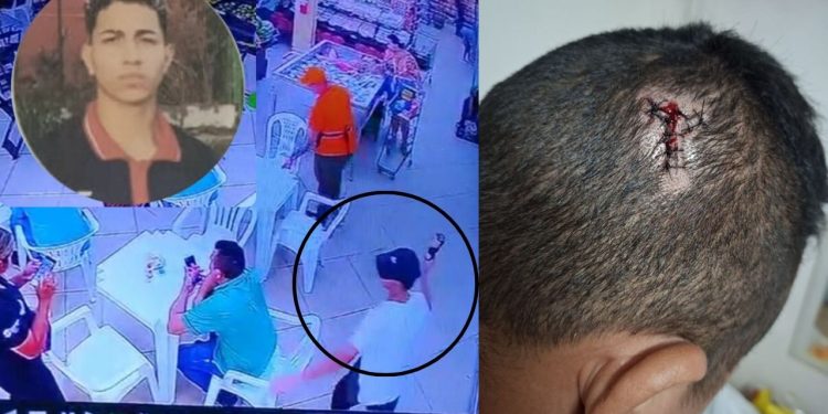 Vídeo: ex-candidato a vaga de emprego da garrafada na cabeça de gerente de supermercado em Manaus