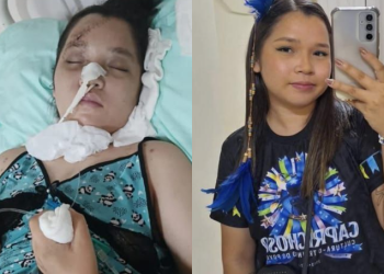 Caprichoso pede doações para universitária que continua internada em Manaus