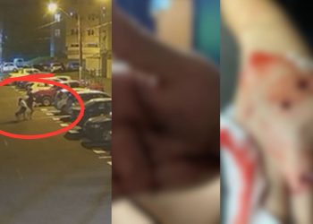 Ataque de pitbull em condomínio deixa duas mulheres feridas em Manaus