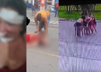 Vídeo: Por causa de 10 reais, travesti deixa rosto de mulher todo 'ticado' em Parintins