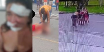 Vídeo: Por causa de 10 reais, travesti deixa rosto de mulher todo 'ticado' em Parintins