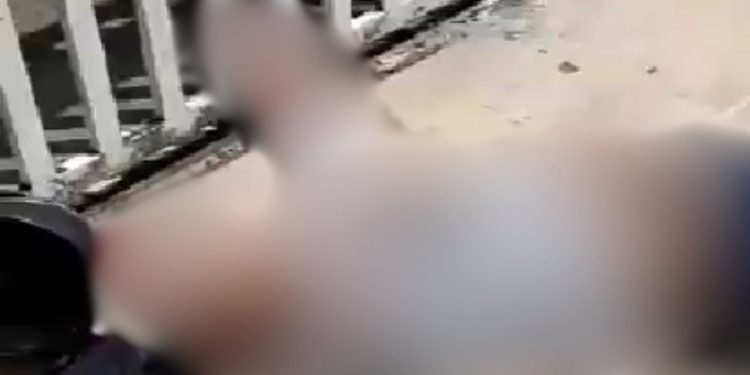 Assaltante lamenta após ser baleado por justiceiro em Manaus: "Tô na vida errada"