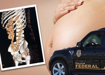 Eram 80 cápsulas – Mula é presa com cocaína no estômago em voo para Europa