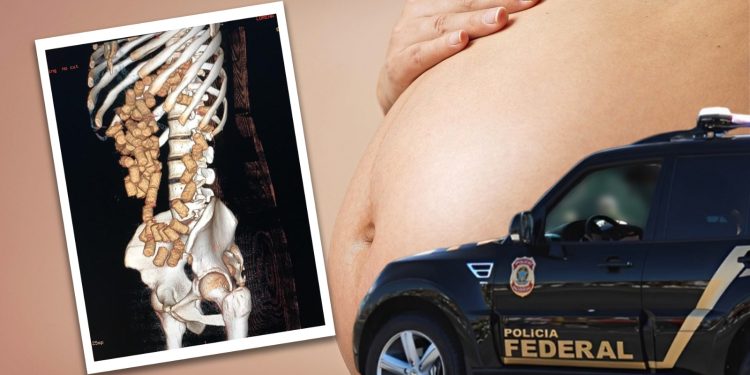 Eram 80 cápsulas – Mula é presa com cocaína no estômago em voo para Europa
