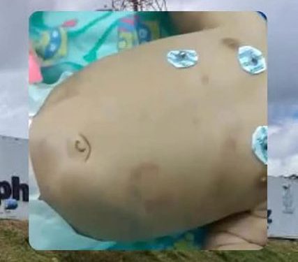 Morre bebê de 3 meses – Polícia investiga se sofreu abuso