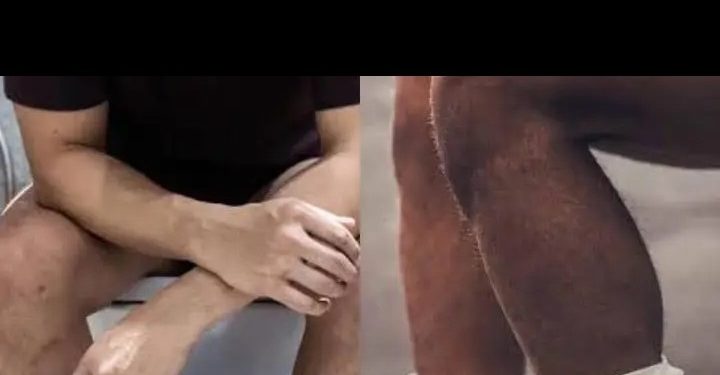 LÁ ELES – Cada vez mais os homens mijam sentados ou de cócoras