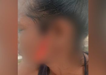 Briga por causa de macho acabou em tentativa de homicídio