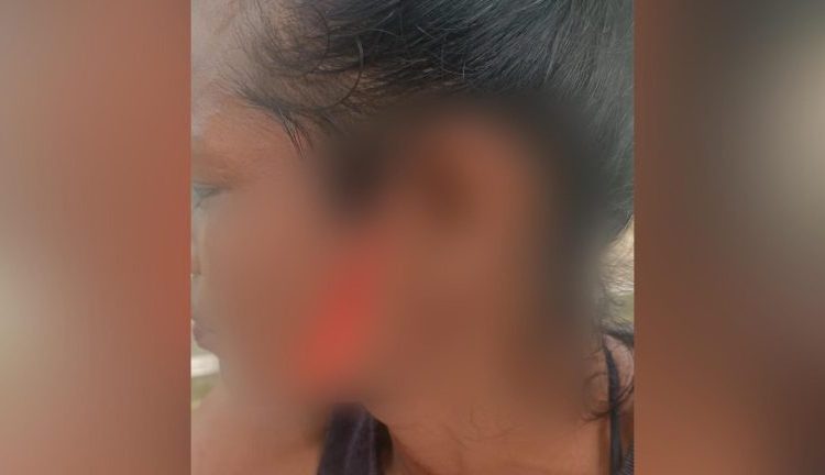 Briga por causa de macho acabou em tentativa de homicídio