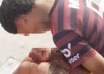 Vagabundo pega tiro nas duas mãos após tentar furtar