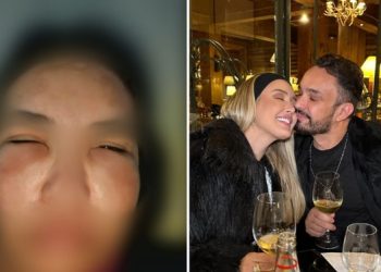 Mais de 100 pacientes foram deformados em clínica de estética de casal famoso