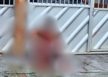 Veja como ficou o homem que foi atacado com golpes de terçado em Manacapuru