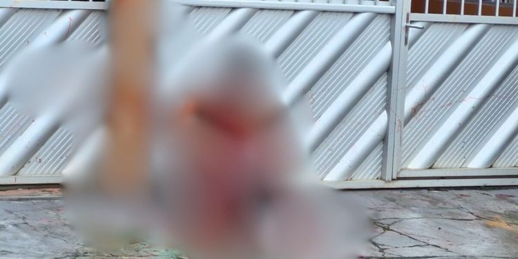 Veja como ficou o homem que foi atacado com golpes de terçado em Manacapuru