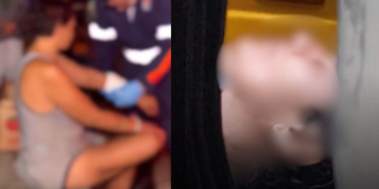 Moradora de rua que foi esfaqueada na Praça da Matriz não quis dizer quem foi a feriu