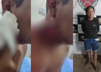 Vídeo forte mostra taxista que levou facada no pescoço de passageira no interior do Amazonas