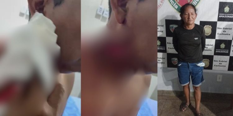 Vídeo forte mostra taxista que levou facada no pescoço de passageira no interior do Amazonas