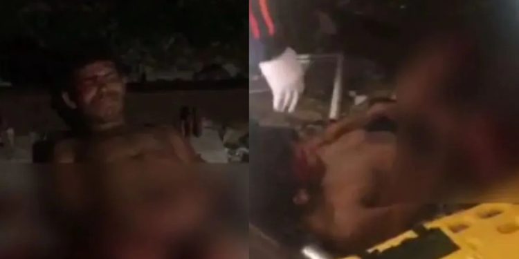 Vídeo forte mostra homem que teve as pernas 'toradas' por trem