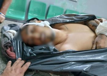 Trocou tiro com os ‘Ursinhos” e levou farelo na ilharga