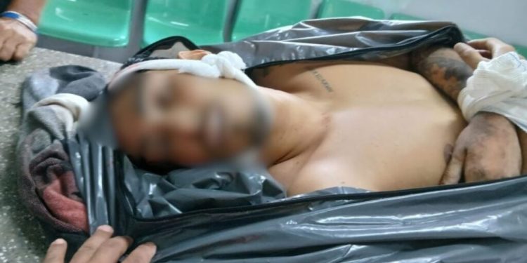 Trocou tiro com os ‘Ursinhos” e levou farelo na ilharga