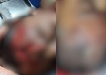 Ao pular no rio, criança bate a cabeça em tronco e fica com a testa aberta no AM