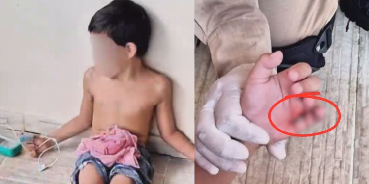 Ao cair em piscina, criança de 6 anos fica com gancho preso na mão em Manaus